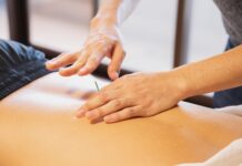 Five Amazing Benefits Of Dry Needling Therapy Dry Needling Therapy
