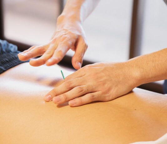 Five Amazing Benefits Of Dry Needling Therapy Dry Needling Therapy