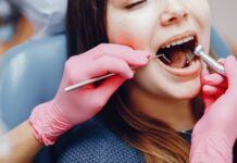 Composite Bonding: A Quick Guide to a Hollywood Smile Composite Bonding