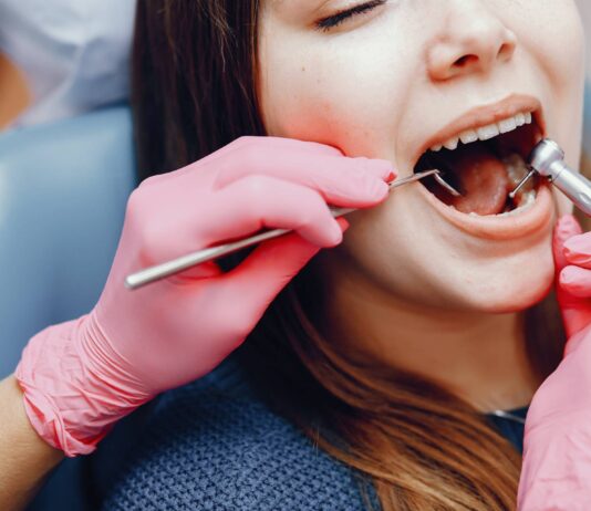 Composite Bonding: A Quick Guide to a Hollywood Smile Composite Bonding