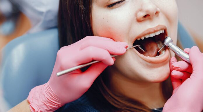 Composite Bonding: A Quick Guide to a Hollywood Smile Composite Bonding