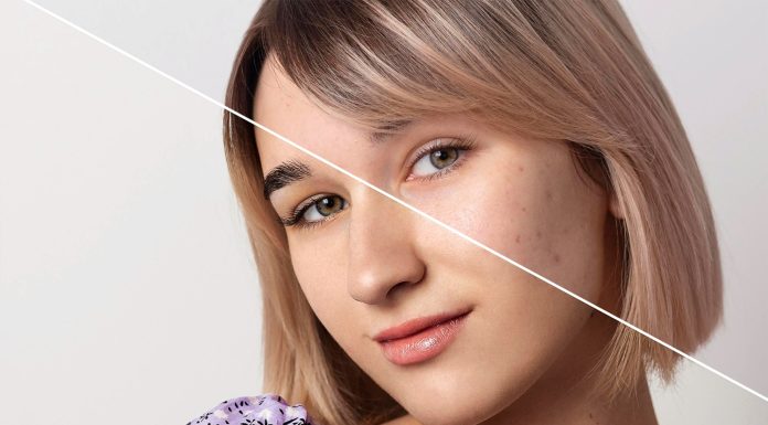 Expert Tips for Successful Skin Rejuvenation Skin Rejuvenation