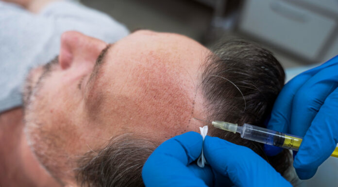 PRP vs Hair Transplant: Which Treatment Is Right for You? PRP vs Hair Transplant