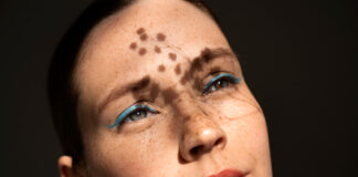 Understanding What Skin Pigmentation Is Pigmentation
