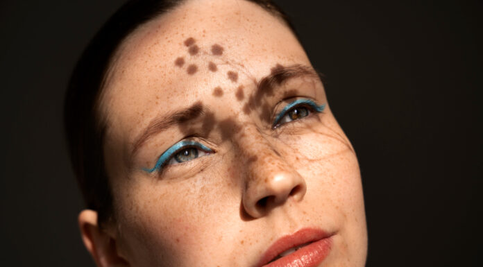 Understanding What Skin Pigmentation Is Pigmentation