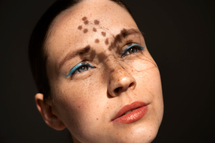 Pigmentation